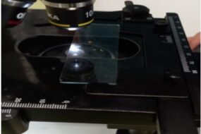 Lombrices al microscopio